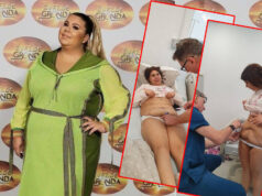 Skinula 92 kilograma i višak kože pa fotografijama sa plaže zapalila mreže