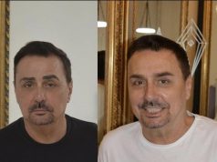 Keba se počastio novim obrvama za 600 eura: Poslije tetoviranja i trajne šminke, sad se odlučio na ovaj korak!