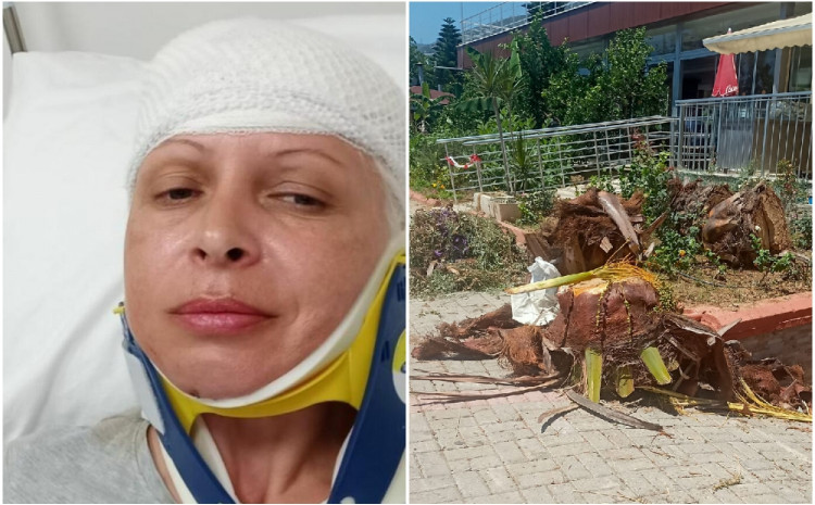 Agonija na ljetovanju u Turskoj: U bašti hotela pala joj palma na glavu… Bolnica, šivenje, ogromni troškovi!