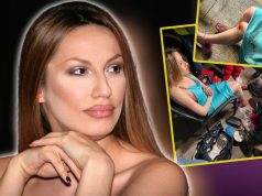NE SPAVAM 3 NOĆI, POD STRESOM SAM! Rada Manojlović povrijedila nogu i ne može da dođe sebi, plaši se da savije koljeno