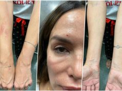 KRVAVA, IZGREBANA I U PODLIVIMA! Ovo su prve fotografije Severine nakon hapšenja