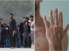 U kampu u Blažuju migrant zaražen majmunskim boginjama!?