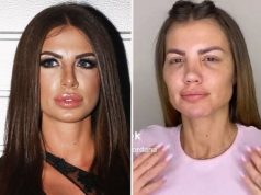 NAKON SEDME OPERACIJE NE LIČI NA SEBE Ni majka je ne bi prepoznala: Evo na šta liči Dragana Mitar nakon silnih operacija!