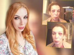 NATAŠA MAZA TVRDI: “Prebili su me drug Kristijana Golubovića i njegova žena”! Pjevačica u modricama i podlivima
