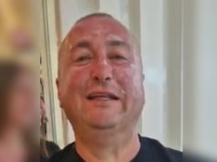 Đani sav u opekotinama! Pjevač zakukao na sav glas: Ja sam gotov, niko ne može da me prepozna