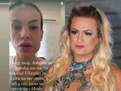 Ermina Pašović morala na hitnu operaciju: Otkrivena joj cista na nervnom sistemu, objavila uznemirujuću sliku