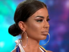 Sanja Grujić izvadila biopolimer iz usana pa pokazala kako izgleda nakon operacije (Foto + Video)