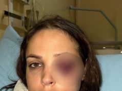 RANA JOJ GNOJI, STRAHUJE DA NE DOBIJE SEPSU! Novi detalji o stanju mučki prebijene Šavije, starleta u agoniji javno moli za pomoć