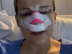 PLASTIČNIM OPERACIJAMA bivša takmičarka “Zadruge” izmijenila lični opis: Iskeširala više od 15.000 eura i sada je druga žena