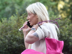 Dušica Jakovljević skinula zavoje i pokazala novo lice: Radila nos, vrat i ruke, ovako izgleda nakon svih operacija!
