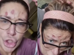 NOVI UZNEMIRUJUĆI SNIMAK! Ana Nikolić kuka na sav glas i moli da joj se uplati novac: Dobiću vaške, vidi na šta ličim! (VIDEO)