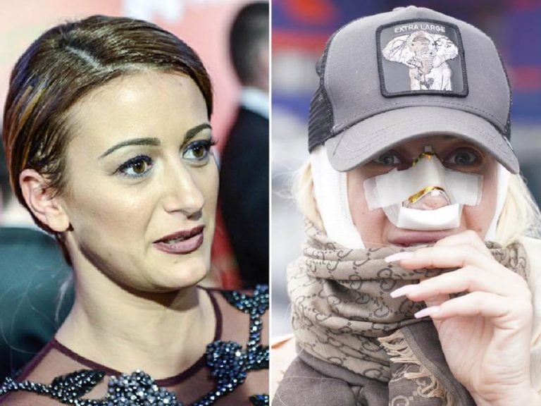 “PA OVO VIŠE NIJE ISTA ŽENA!” Šok fotke Dušice Jakovljević – voditeljka prije i poslije operacija, evo šta je sve korigovala