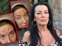 “NIJE OD LASERA, IMA RANE I PO TIJELU!” GOCA BOŽINOVSKA OTKRILA DETALJE SUSRETA SA ANOM NIKOLIĆ