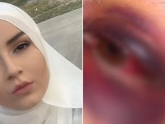 OGLASILA SE MLADA ŽENA KOJU JE U TURBETU PRETUKAO SUPRUG PRED NJIHOVOM BEBOM: Opisala nasilje i poslala bitnu poruku mladim ženema