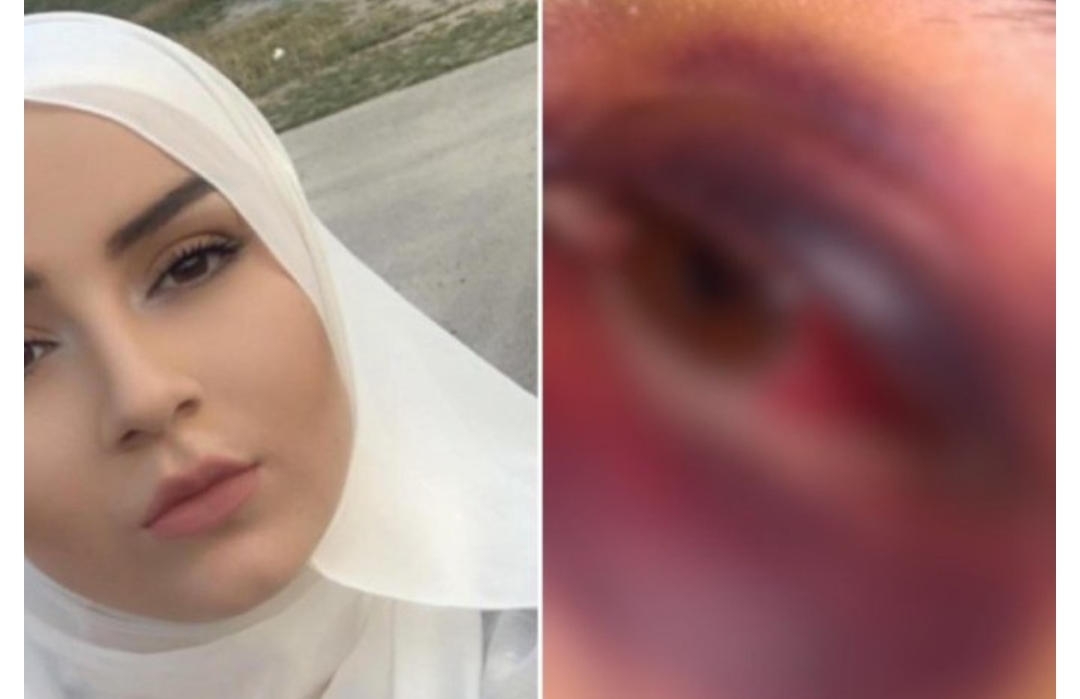 OGLASILA SE MLADA ŽENA KOJU JE U TURBETU PRETUKAO SUPRUG PRED NJIHOVOM BEBOM: Opisala nasilje i poslala bitnu poruku mladim ženema OGLASILA SE MLADA ŽENA KOJU JE U TURBETU PRETUKAO SUPRUG PRED NJIHOVOM BEBOM: Opisala nasilje i poslala bitnu poruku mladim ženema