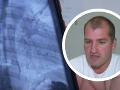 Stanko je u restoranu naručio mineralnu, a kad je otpio, spalila mu je jednjak: ‘Da sam popio više, ne bi me bilo‘