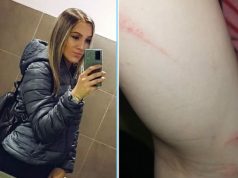 Mladu ženu iz Tešnja suprug brutalno tukao: Osim što me zlostavljao, prevario me, a za sina ga nije briga