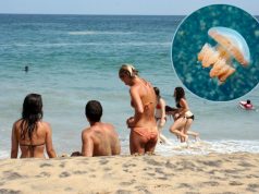 DJEVOJČICA VRIŠTALA OD BOLOVA NA PLAŽI U GRČKOJ, IMA TEŠKE OPEKOTINE: Oprez, ovo može da se desi svakom, lečenje traje čak 6 mjeseci