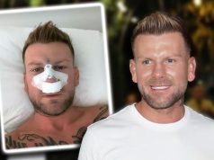 HITNO OPERISAN STANISLAV KROFAK! Procurila fotografija iz bolnice, učesnik Elite u zavojima i modricama (FOTO)