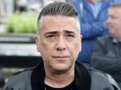 Željko Joksimović o Lepoj Breni: Žao mi je zbog povrede, ona je sada sa šrafovima u nogama!