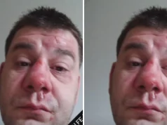 IVAN MARINKOVIĆ IZGREBAN I PRETUČEN! Pojavila se jeziva fotografija