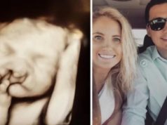 Doktori su mi rekli “ABORTIRAJ” kada su vidjeli ultrazvuk bebe: Nismo ih poslušali i moj sin danas ima 6 godina i izgleda ovako