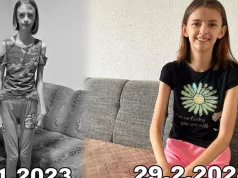 Tinejdžerka zbog teške bolesti sa 18 god. imala samo 35 kilograma, nakon godinu dana izašla kao pobjednica: “Više mi se neće smijati što sam mršava”