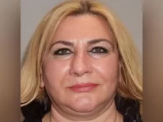 Turci ovom transformacijom sami sebe prevazišli: Od sredovječne žene napravili djevojku, poslije 5 intervencija ljudi gledaju u nju u nevjerici (FOTO)