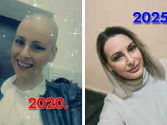 Jasmina prošla 31 zračenje i 16 kemoterapija, danas s ponosom kaže “Uspjela sam”: Ova slika je simbol pobjede