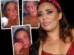 Šta se desilo Ani Nikolić? ŠIKLJA K*V iz oka, snimila se u jezivom stanju…