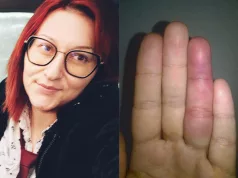 Ramizu tukao suprug, institucije u Kalesiji joj rekle: “Nemojte da nas više bespotrebno zovete”