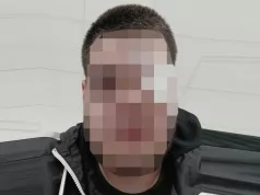 OVO JE PRETUČENI UČENIK ELEKTROTEHNIČKE ŠKOLE Tinejdžeru polomljena jagodična kost, sa povredama primljen u bolnicu (FOTO)