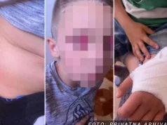 Dječak (7) kojeg je školski drug gurnuo niz stepenice primljen u bolnicu, oglasila se majka: “STANJE MU SE POGORŠALO” (FOTO)