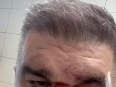 SAŠU MIRKOVIĆA SPREMAJU ZA OPERACIONU SALU NAKON BRUTALNOG NAPADA I POKUŠAJA UBISTVA
