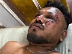ON JE PREŽIVIO STRAVIČAN PAD AVIONA! “Tijela su bila svuda, ustao sam i trčao”: Otkrio da je prije katastrofe čuo JEDAN ZVUK (FOTO, VIDEO)