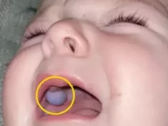 Šokirani doktori mislili da beba ima tumor u ustima sve dok nisu otkrili alarmantnu istinu: ‘Budite jako oprezni’
