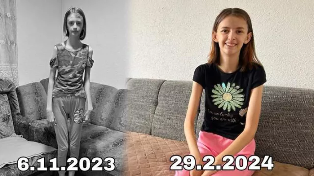Evresa Velić iz Bužima: Od 35 kilograma do pobjede nad bolešću