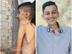 SVIJET ŠUTI DOK GAZA GLADUJE Ahmed umro jer mu je uskraćena osnovna hrana