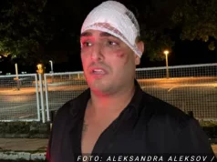 Darko Lazić u teretani pokazao ožiljak i drastičnu promjenu izgleda