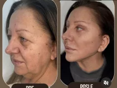 Nevjerovatna transformacija: Doktor Rizinski od bake napravio djevojku — estetska čuda postoje
