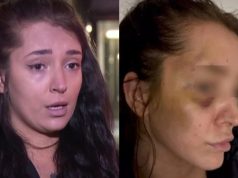Goraždanka Adna Borovac brutalno pretučena, policija tražila da se umije kako bi „provjerili šminku“
