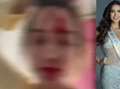 Incident u Cannesu: Manekenka tvrdi da ju je stilist napao makazama, objavila uznemirujući snimak